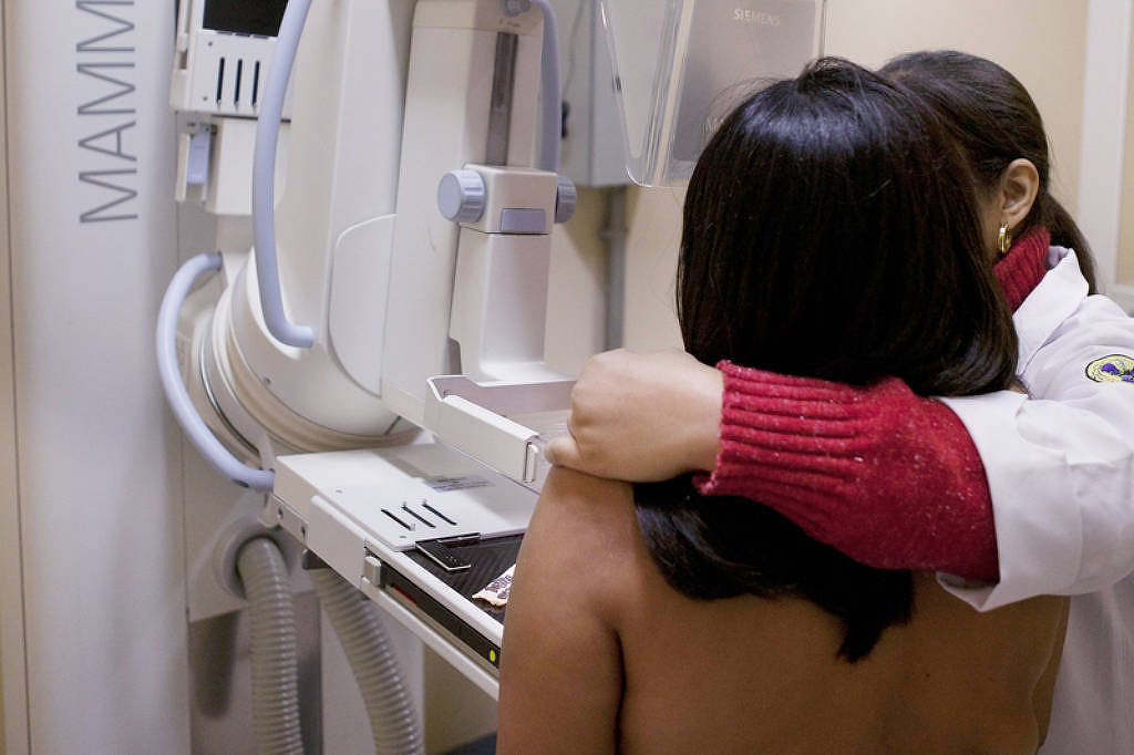 senado-aprova-projetos-que-antecipam-idade-minima-para-mamografia-no-sus