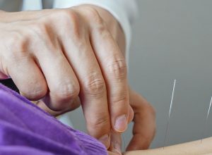 brasil-regulamenta-exercicio-profissional-da-acupuntura