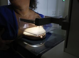 ans-defende-que-plano-cubra-mamografia-digital-sem-restricao-de-idade